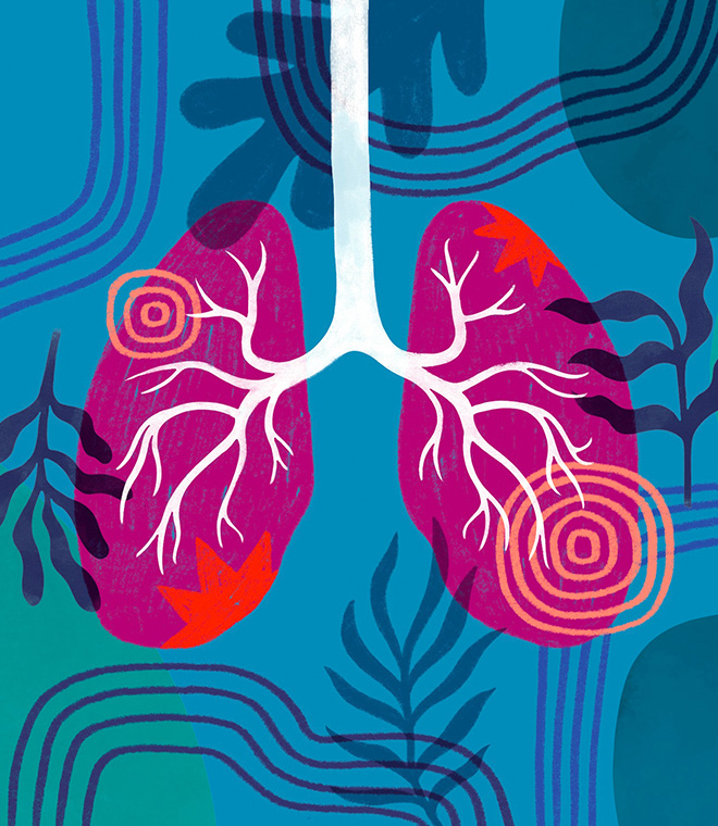 Illustration of lungs