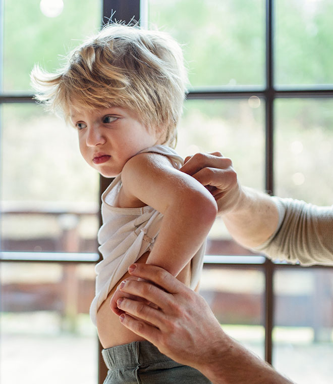 Young boy scratching his back