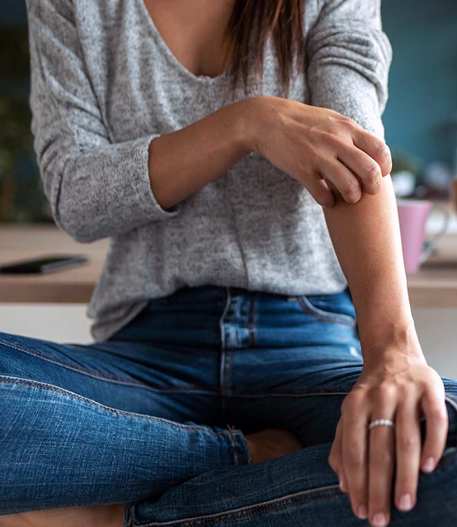 Woman sitting down and scratching her itchy arm