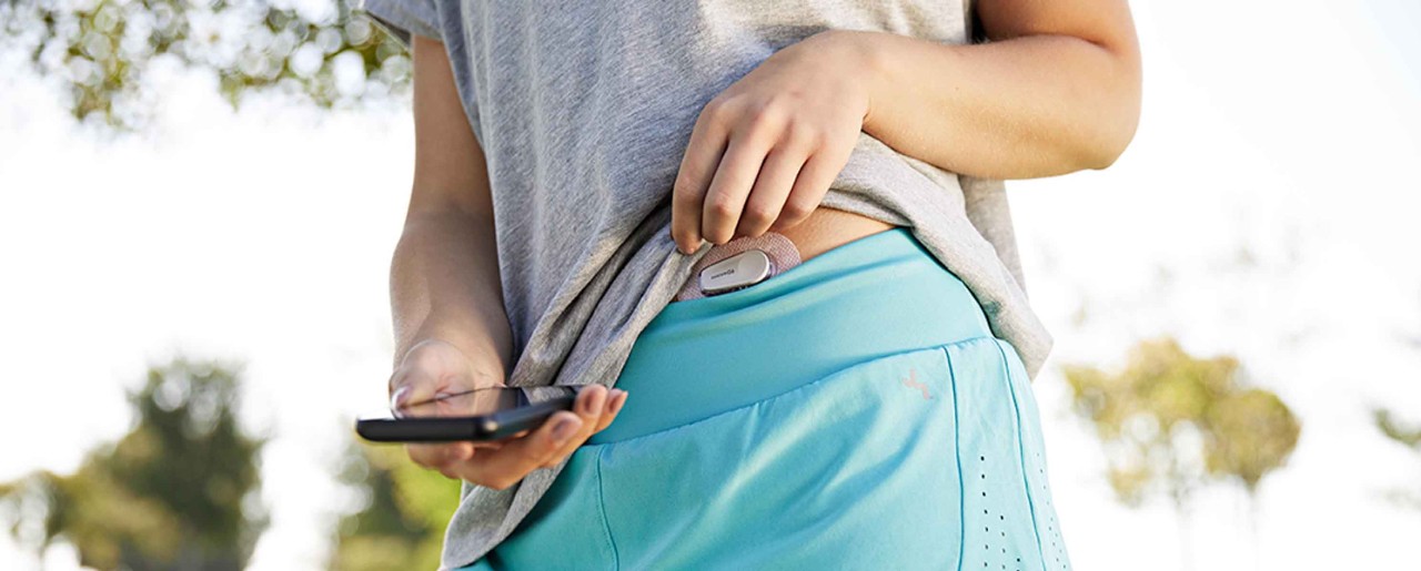 Woman with Omnipod and Dexcom